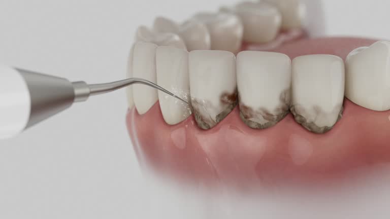 Reliable Dental contractor in Monteagle, TN by Smile Center Dentistry